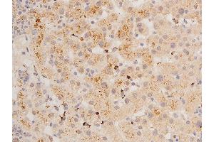 Immunohistochemistry (IHC) image for anti-Tumor Protein P53 (TP53) (pSer392) antibody (ABIN6256312)