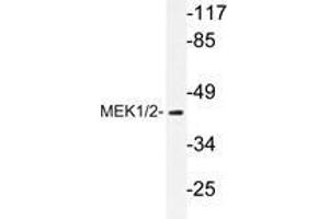 Western blot analyzes of MEK1/2 antibody in extracts from HT-29 cells. (MEK1 antibody)