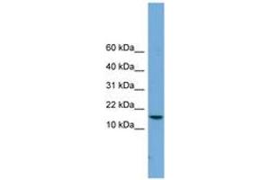 Image no. 1 for anti-P Antigen Family, Member 4 (Prostate Associated) (PAGE4) (C-Term) antibody (ABIN6744720) (PAGE4 antibody  (C-Term))