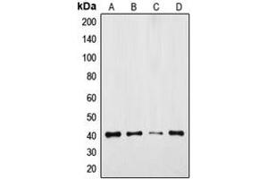 Western blot analysis of GPR175 expression in DLD (A), Jurkat (B), mouse colon (C), rat colon (D) whole cell lysates.