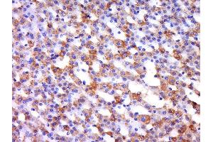 Paraformaldehyde-fixed, paraffin embedded rat adrendal gland, Antigen retrieval by boiling in sodium citrate buffer (pH6) for 15min, Block endogenous peroxidase by 3% hydrogen peroxide for 30 minutes, Blocking buffer (normal goat serum) at 37°C for 20min, Antibody incubation with 	Rabbit Anti-Integrin alpha L/CD11a Polyclonal Antibody, Unconjugated  at 1:500 overnight at 4°C, followed by a conjugated secondary and DAB staining. (ITGAL antibody  (AA 251-350))