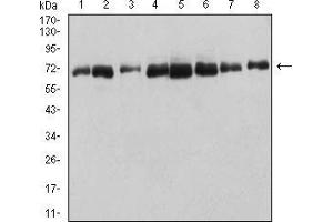 Western blot analysis using DDX5 mouse mAb against HT-29 (1), Hela (2), NIH/3T3 (3), COS7 (4), SW620 (5), Jurkat (6), A431 (7), and MCF-7 (8) cell lysate. (DDX5 antibody  (AA 475-614))