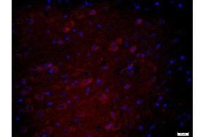 Paraformaldehyde-fixed, paraffin embedded mouse brain tissue, Antigen retrieval by boiling in sodium citrate buffer(pH6) for 15min, Block endogenous peroxidase by 3% hydrogen peroxide for 30 minutes, Blocking buffer (normal goat serum) at 37°C for 20min, Antibody incubation with Rabbit Anti-HEG1 Polyclonal Antibody, Unconjugated  at 1:400 overnight at 4°C, followed by a biotin conjugated secondary for 20 minutes at 37°C, followed by a conjugated streptavidin -Cy3) at 1:500 for 40 minutes and DAPI staining of the nuclei (HEG1 antibody  (AA 1151-1381))