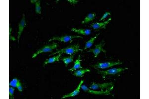 Immunofluorescent analysis of Hela cells using ABIN7156146 at dilution of 1:100 and Alexa Fluor 488-congugated AffiniPure Goat Anti-Rabbit IgG(H+L) (Caspase 12 antibody  (AA 61-282))