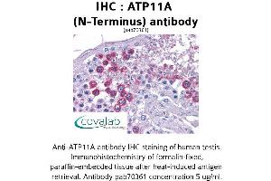 Image no. 1 for anti-ATPase, Class VI, Type 11A (ATP11A) (N-Term) antibody (ABIN1732072)