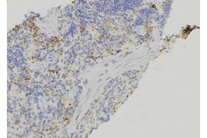 ABIN6278924 at 1/100 staining Human lymph node tissue by IHC-P. (Keratin 3 antibody  (C-Term))