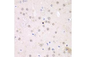 Immunohistochemistry of paraffin-embedded rat brain using FMRP Antibody (ABIN6127908, ABIN6140718, ABIN6140720 and ABIN6221284) at dilution of 1:100 (40x lens). (FMR1 antibody  (AA 1-290))