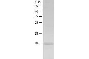 Western Blotting (WB) image for Chemokine (C-C Motif) Ligand 4-Like 1 (CCL4L1) (AA 24-92) protein (His tag) (ABIN7287986) (CCL4L1 Protein (AA 24-92) (His tag))