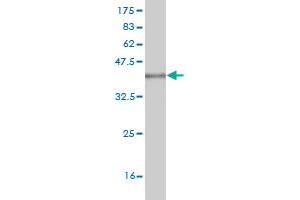 Western Blot detection against Immunogen (36. (ITGB1BP1 antibody  (AA 101-200))
