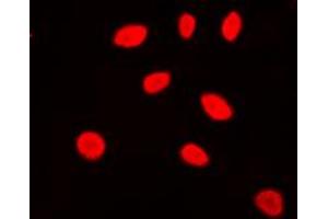 Immunofluorescent analysis of ZNF174 staining in Jurkat cells. (ZNF174 antibody  (Center))