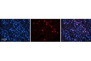Rabbit Anti-RAD54B Antibody      Formalin Fixed Paraffin Embedded Tissue: Human Adult Liver   Observed Staining: Nuclear in hepatocytes, very strong signal, wide tissue distribution  Primary Antibody Concentration: 1:100  Secondary Antibody: Donkey anti-Rabbit-Cy3  Secondary Antibody Concentration: 1:200  Magnification: 20X  Exposure Time: 0. (RAD54B antibody  (N-Term))