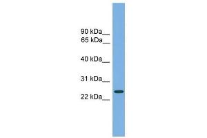 CHMP4B antibody used at 1 ug/ml to detect target protein. (CHMP4B antibody  (Middle Region))