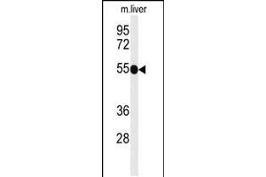 Western blot analysis of TNFRSF8-Y479 in mouse liver tissue lysates (35ug/lane) (TNFRSF8 antibody  (AA 458-487))