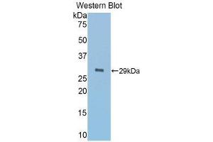 Western Blotting (WB) image for anti-alpha-1-B Glycoprotein (A1BG) (AA 220-415) antibody (ABIN1857837)