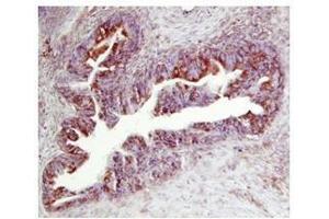 Immunohistochemistry (IHC) image for anti-Metalloproteinase Inhibitor 2 (TIMP2) (N-Term) antibody (ABIN929152)