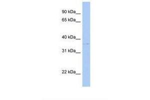 Image no. 1 for anti-Sulfotransferase Family, Cytosolic, 1C, Member 2 (SULT1C2) (C-Term) antibody (ABIN6738537) (SULT1C2 antibody  (C-Term))