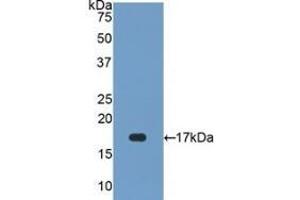 Detection of Recombinant SOD1, Human using Polyclonal Antibody to Superoxide Dismutase 1 (SOD1) (SOD1 antibody  (AA 2-154))
