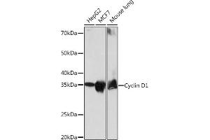 Western blot analysis of extracts of various cell lines, using Cyclin D1 antibody (ABIN7266561) at 1:1000 dilution. (Cyclin D1 antibody)