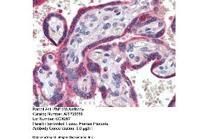 Immunohistochemistry with Human Placenta lysate tissue at an antibody concentration of 5. (ZNF165 antibody  (Middle Region))