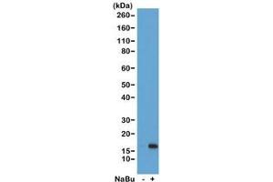 Western blot of acid extracts from HeLa cells untreated (-) or treated (+) with sodium butyrate using recombinant H3K36ac antibody at 1 ug/ml showed a band of Histone H3 acetylated at Lysine 36 in treated HeLa cells. (Recombinant Histone 3 antibody  (acLys36))