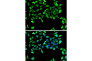 Immunofluorescence analysis of U2OS cells using EIF3H antibody.