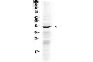 Western blot analysis of NDRG3 using anti- NDRG3 antibody . (NDRG3 antibody  (AA 181-239))