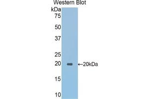 Detection of Recombinant SPTAN1, Mouse using Polyclonal Antibody to Alpha-Fodrin (SPTAN1) (SPTAN1 antibody  (AA 1049-1207))