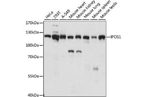 Western blot analysis of extracts of various cell lines, using IPO11 antibody. (Importin 11 antibody)