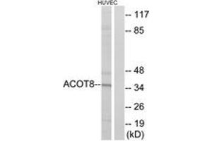 Western blot analysis of extracts from HuvEc cells, using ACOT8 Antibody. (ACOT8 antibody  (AA 131-180))
