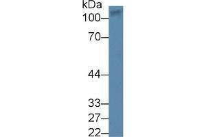 Detection of AMPH in Human Lung lysate using Polyclonal Antibody to Amphiphysin (AMPH) (Amphiphysin antibody  (AA 24-241))