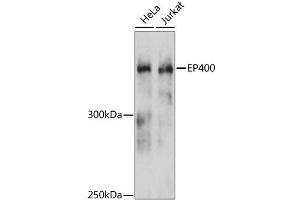 Western blot analysis of extracts of various cell lines, using EP400 antibody. (EP400 antibody)