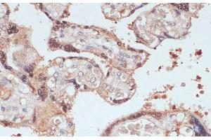 Immunohistochemistry of paraffin-embedded Human placenta using MYCBP Polyclonal Antibody at dilution of 1:100 (40x lens). (MYCBP antibody)