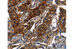 Immunohistochemistry (IHC) image for anti-ATP-Binding Cassette, Sub-Family C (CFTR/MRP), Member 5 (ABCC5) (AA 1-179) antibody (ABIN3017214) (ABCC5 antibody  (AA 1-179))