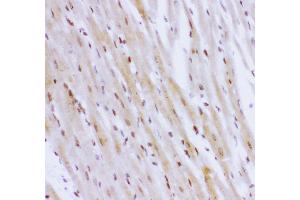 Anti- NR3C1 antibody,IHC(P) IHC(P): Rat Cardiac Muscle Tissue (Glucocorticoid Receptor antibody  (AA 1-373))