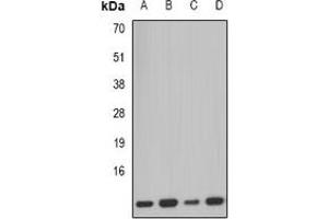 Western blot analysis of PCBD1 expression in SW620 (A), mouse kidney (B), mouse pancreas (C), rat liver (D) whole cell lysates. (PCBD1 antibody)