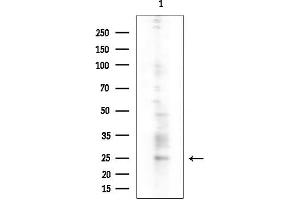 anti-Ras Homolog Family Member D (RHOD) (Internal Region) antibody