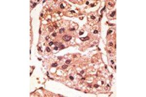Image no. 1 for anti-Presenilin 1 (PSEN1) (C-Term) antibody (ABIN358721) (Presenilin 1 antibody  (C-Term))