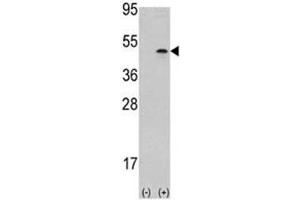 Western blot analysis of Aurora B antibody and 293 cell lysate (2 ug/lane) either nontransfected (Lane 1) or transiently transfected with the AURKB gene (2). (Aurora Kinase B antibody  (AA 283-313))