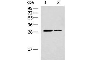 Western blot analysis of Mouse liver tissue and Mouse skeletal muscle tissue lysates using POMC Polyclonal Antibody at dilution of 1:800 (POMC antibody)