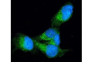 IF analysis of Profilin 1 using anti-Profilin 1 antibody (ABIN3043603). (PFN1 antibody  (C-Term))