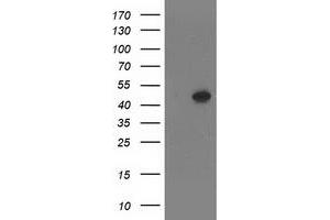 HEK293T cells were transfected with the pCMV6-ENTRY control (Left lane) or pCMV6-ENTRY SETD7 (Right lane) cDNA for 48 hrs and lysed. (SETD7 antibody)