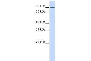 WB Suggested Anti-C2orf3 Antibody Titration: 0. (GCFC2 antibody  (N-Term))