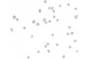 Immunohistochemistry (IHC) image for anti-Zinc Finger E-Box Binding Homeobox 2 (ZEB2) (C-Term) antibody (ABIN1030819) (ZEB2 antibody  (C-Term))