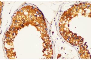 Immunohistochemistry of paraffin-embedded Human testis using LDHC Polycloanl Antibody at dilution of 1:200 (Lactate Dehydrogenase C antibody)