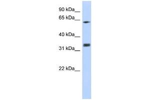 Western Blotting (WB) image for anti-Guanine Nucleotide Binding Protein (G Protein), beta Polypeptide 2-Like 1 (GNB2L1) (N-Term) antibody (ABIN2778965)
