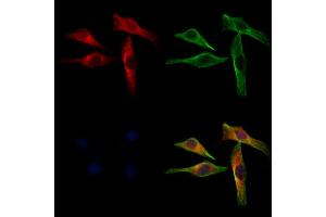 ABIN6262942 and ABIN6272945 staining 3 by IF/ICC.