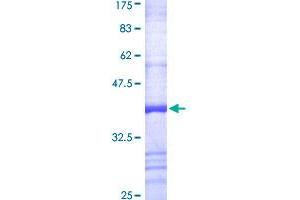 IDS Protein (AA 38-137) (GST tag)