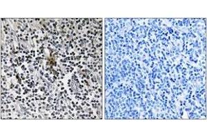 Immunohistochemistry (IHC) image for anti-Ribosomal Protein S3 (RPS3) (AA 171-220) antibody (ABIN2890066) (RPS3 antibody  (AA 171-220))