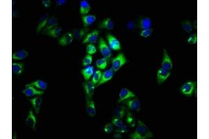Immunofluorescence staining of Hela cells with ABIN7152658 at 1:33, counter-stained with DAPI. (FCRL3 antibody  (AA 122-222))