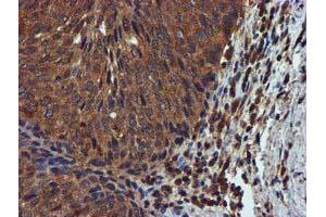 Image no. 3 for anti-Complement Component 1, S Subcomponent (C1S) antibody (ABIN1497565) (C1S antibody)